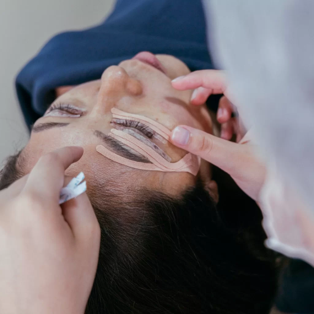 Blefaroplastia pálpebra caída