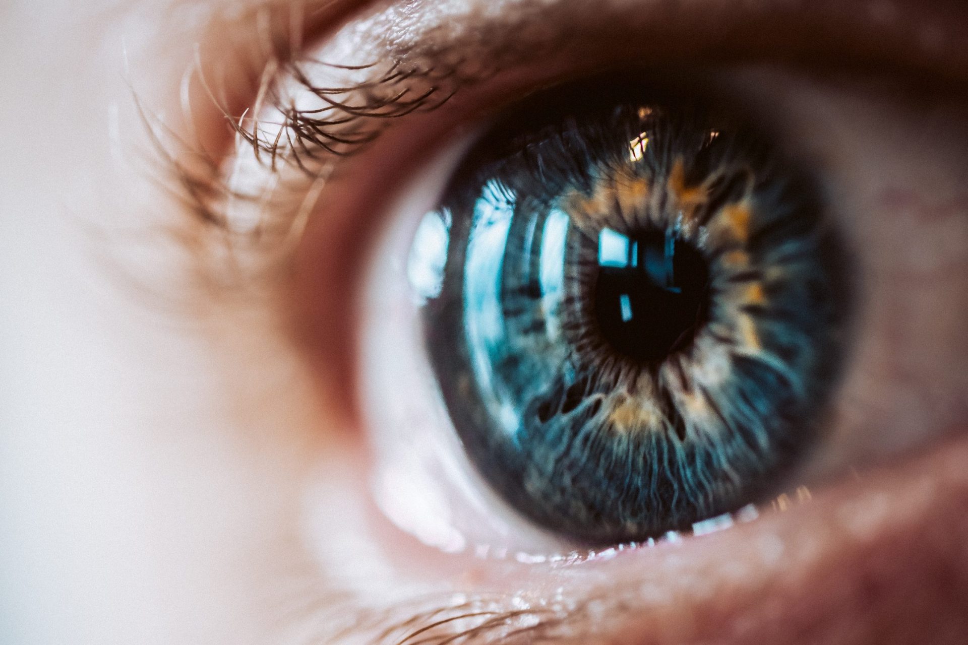 Blefaroplastia mal executada - foto de um olho