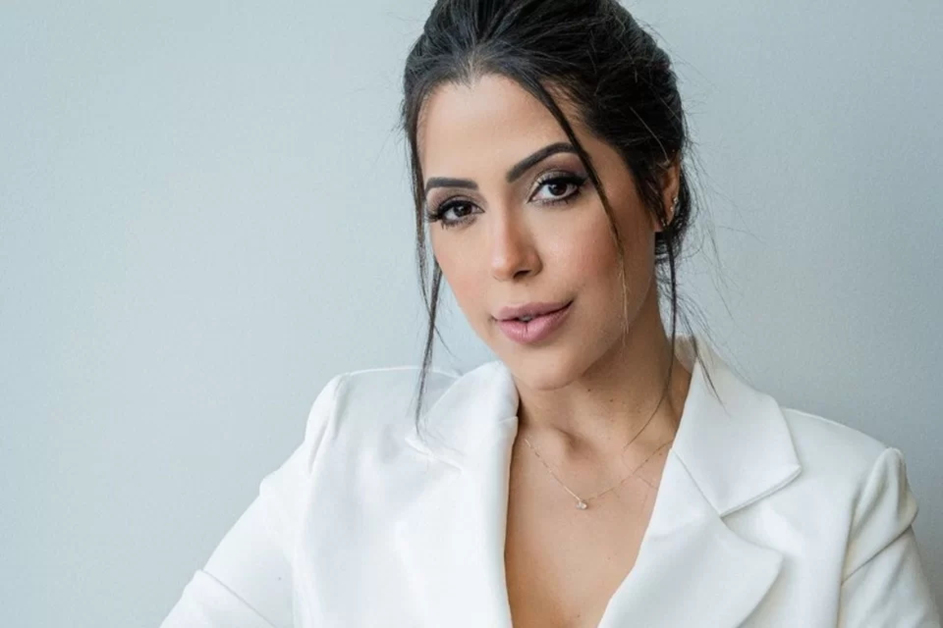 Blefaroplastia Antes e depois