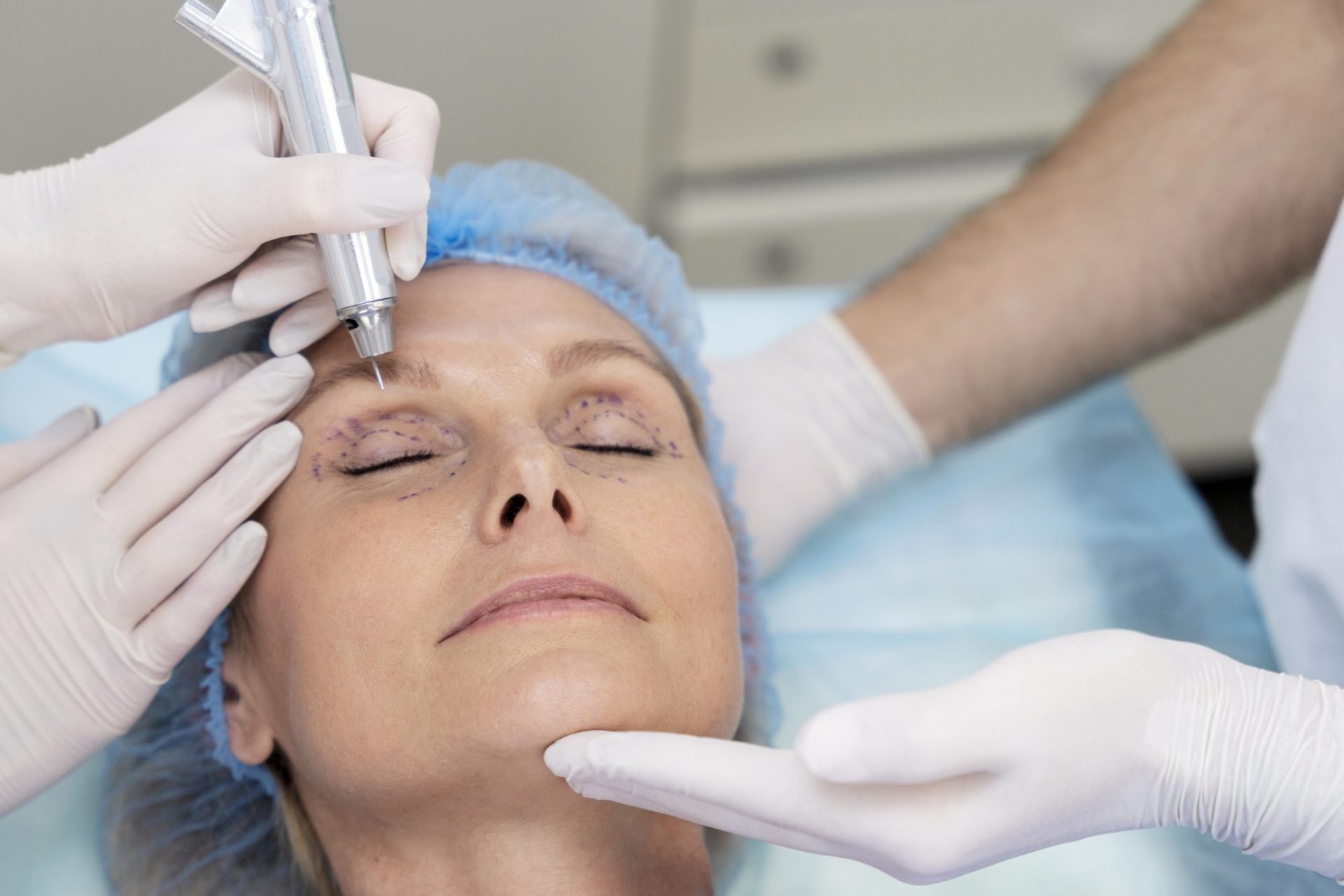 Cirurgia de blefaroplastia