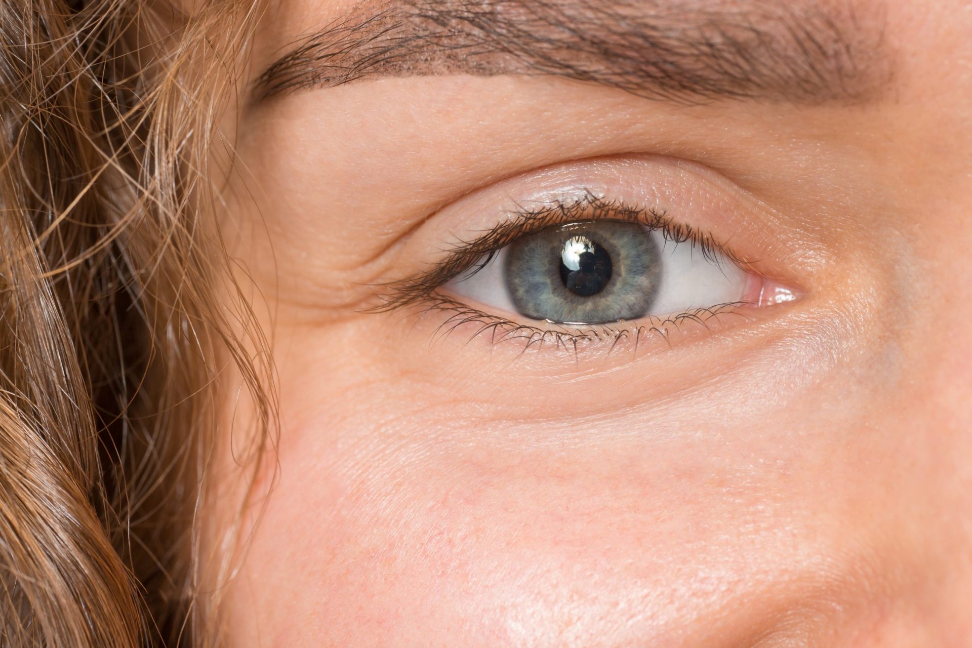 Fiz blefaroplastia e me arrependi