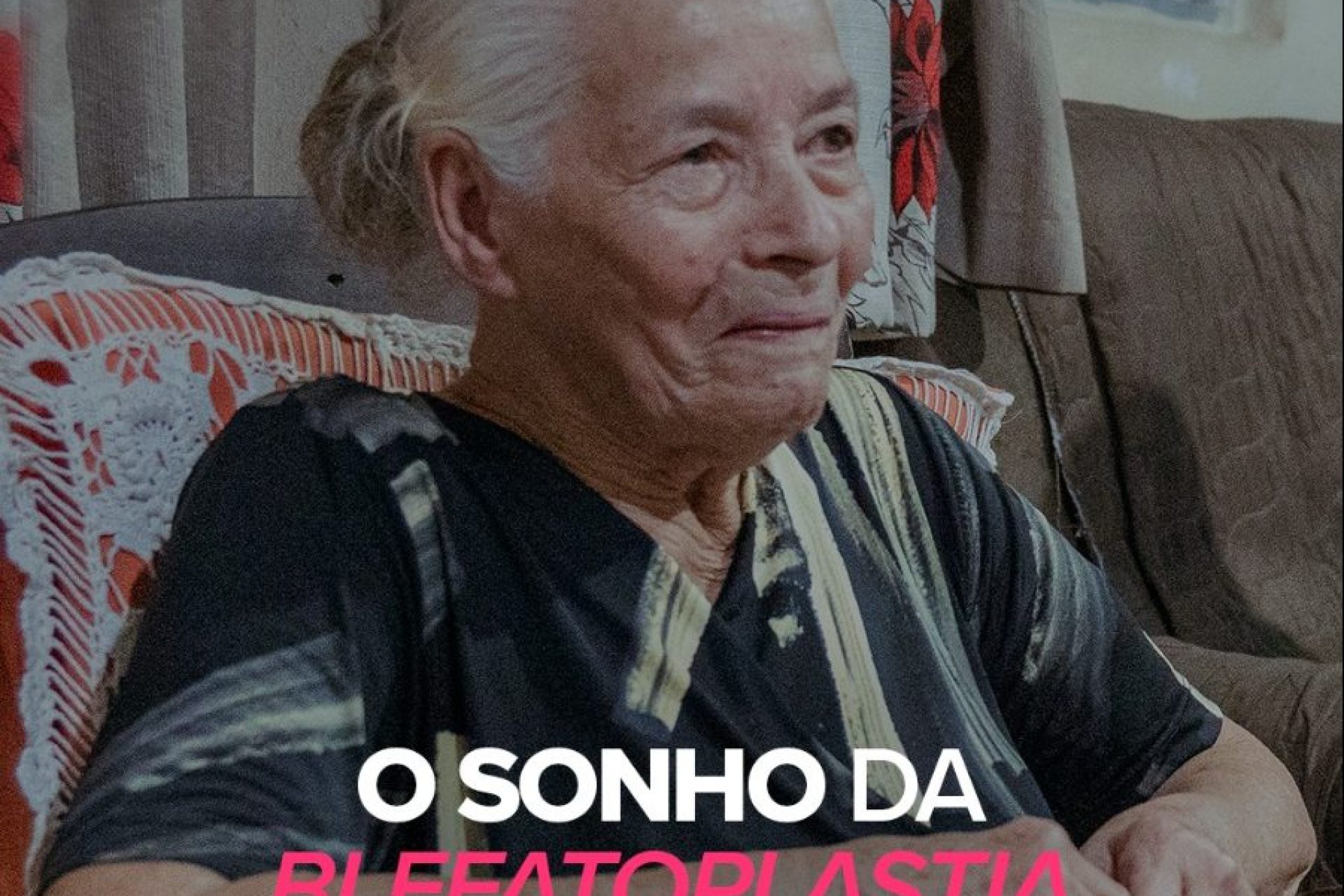 Blefaroplastia severina maria