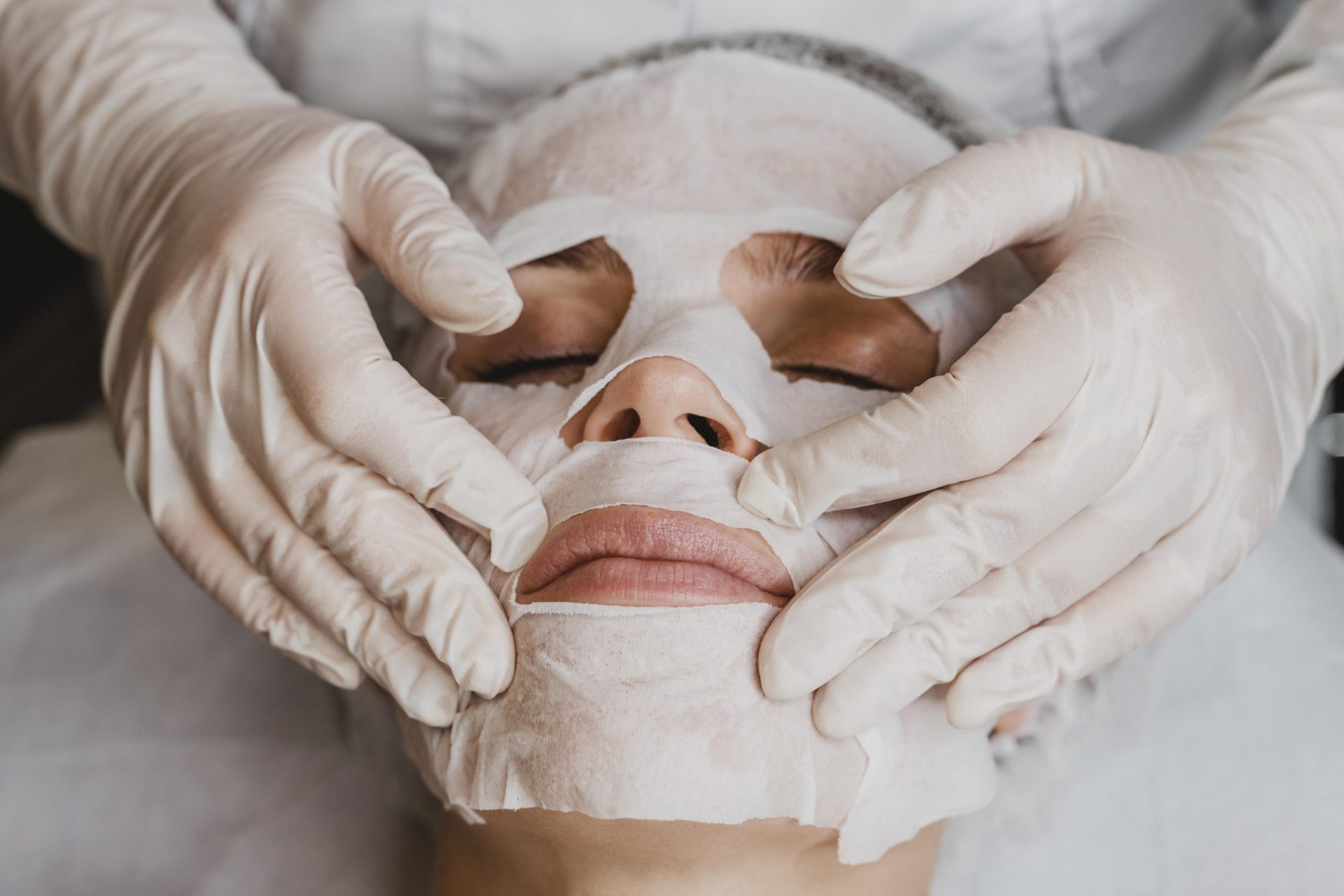 Peeling de fenol - procedimentos estéticos