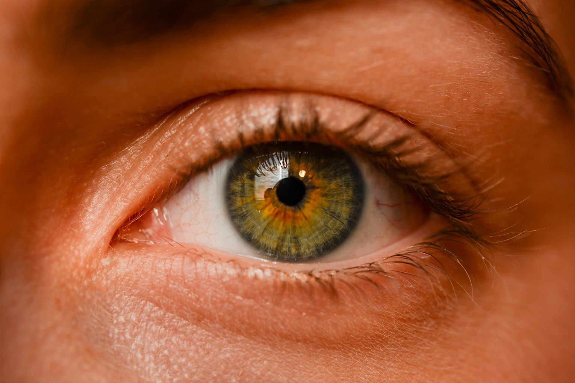 Visão Turva blefaroplastia