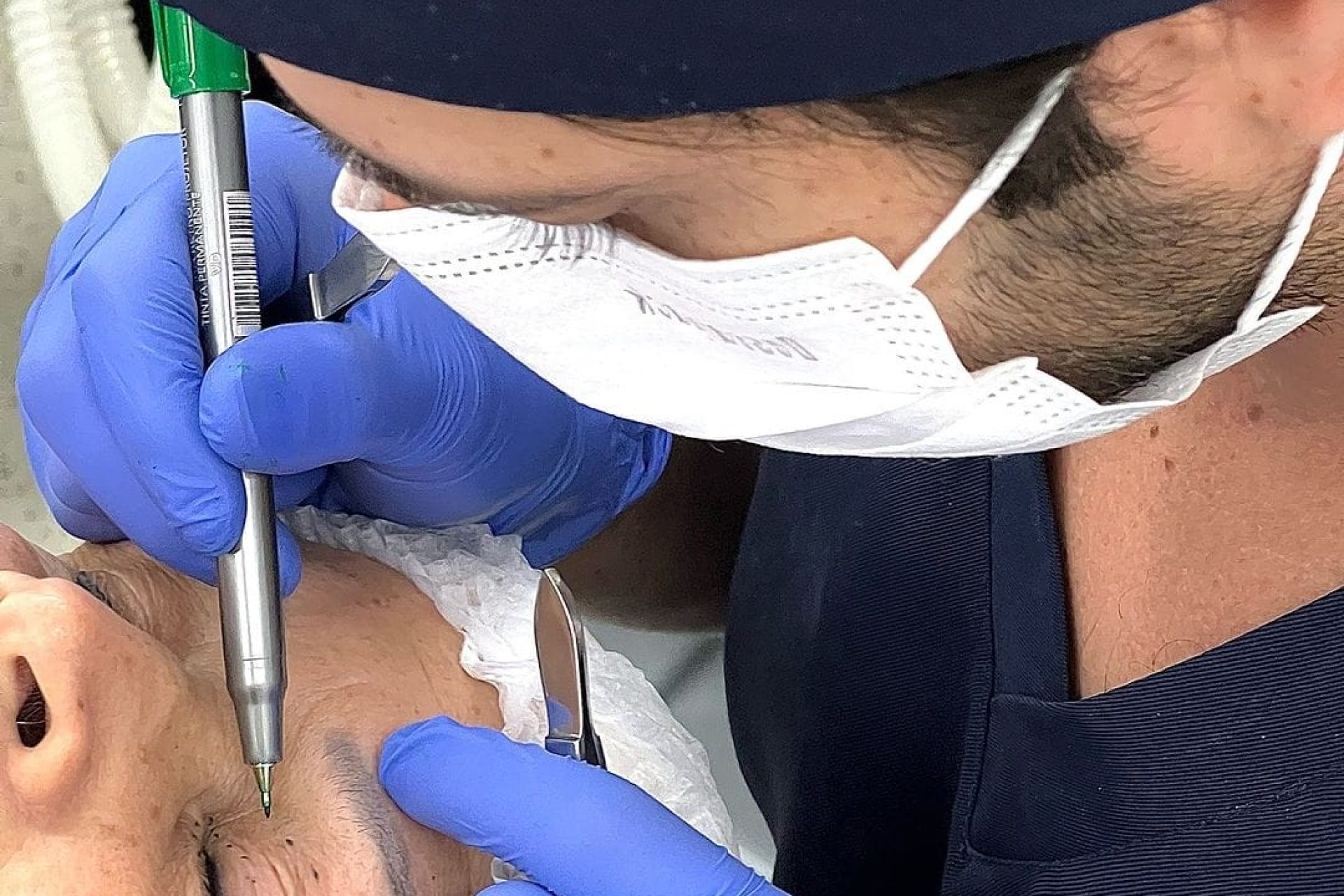 blefaroplastia-instituto-pedro-ruiz-2