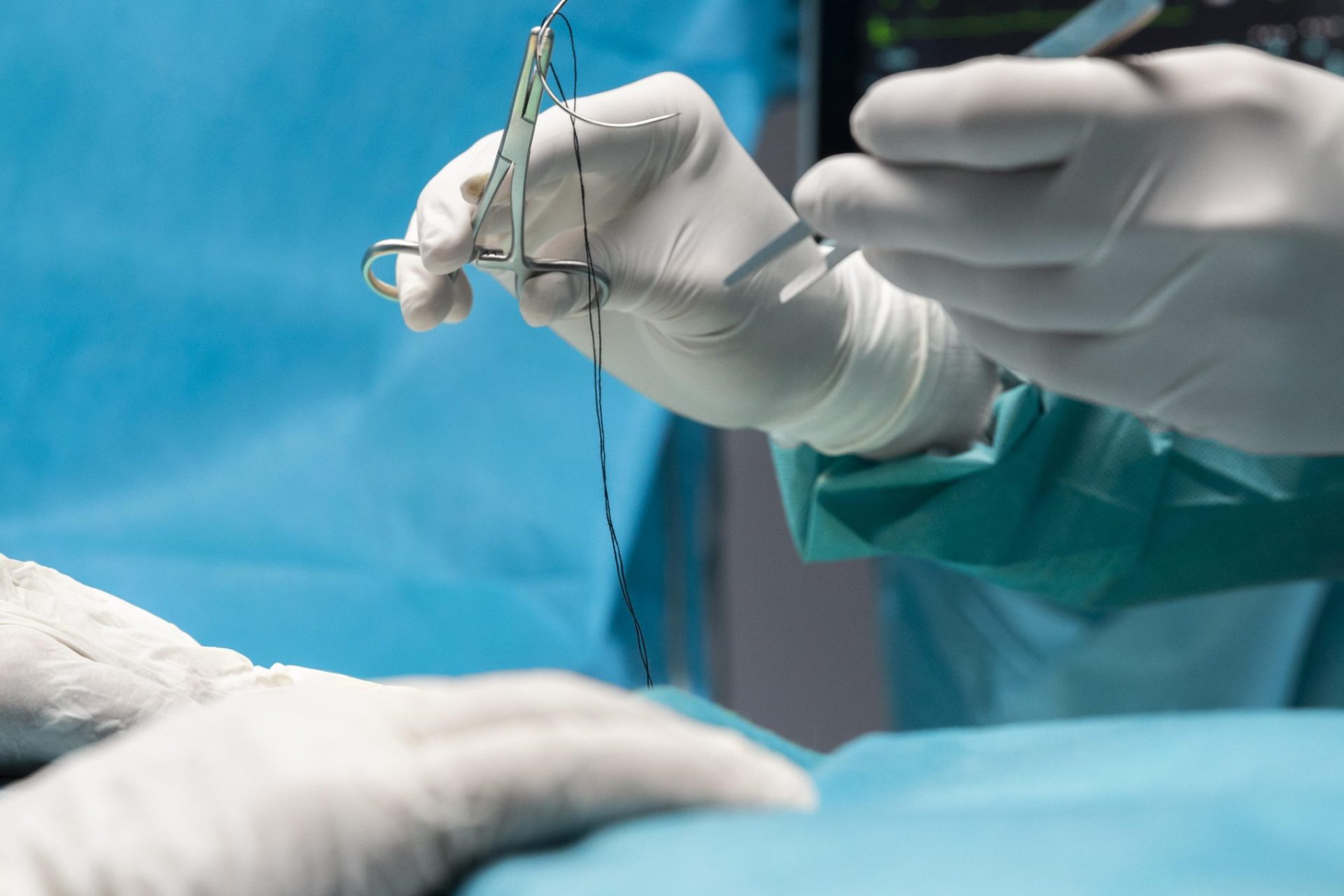 blefaroplastia sem ponto
