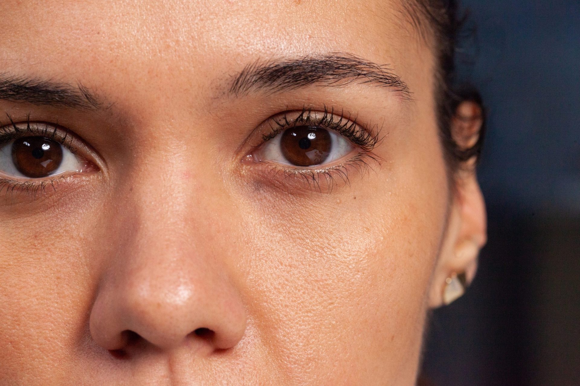 Blefaroplastia Beleza