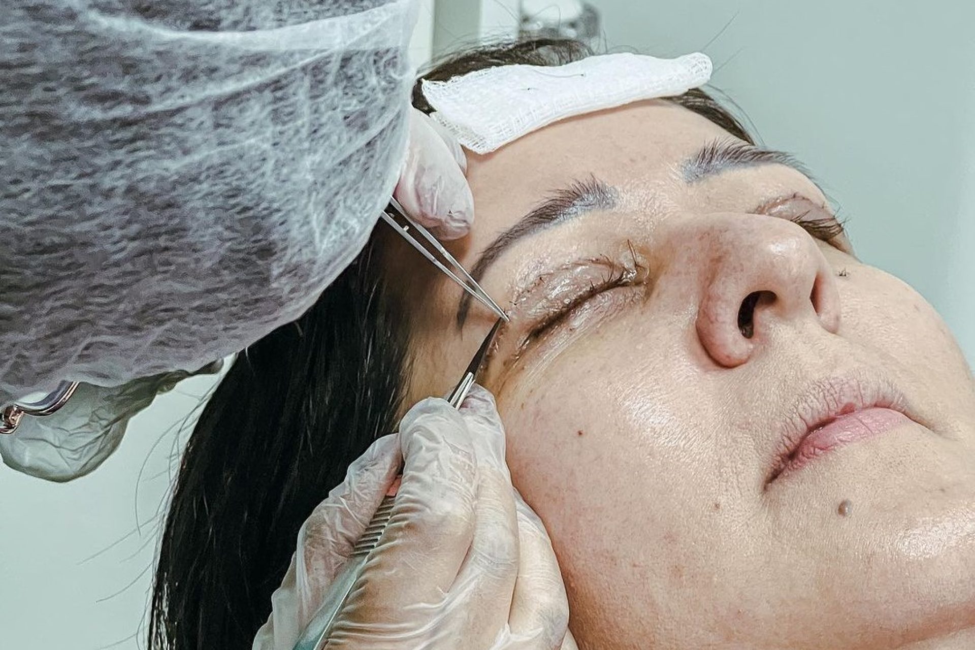 saber-antes-de-fazer-blefaroplastia